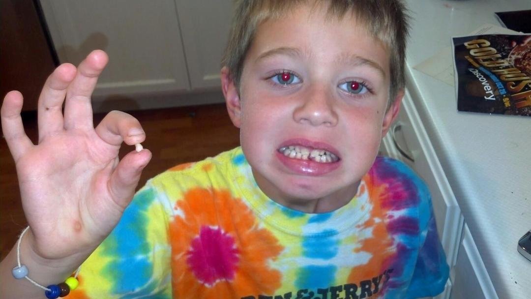 And the first tooth is gone.