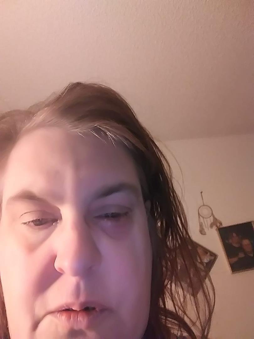 something wrong with my eye