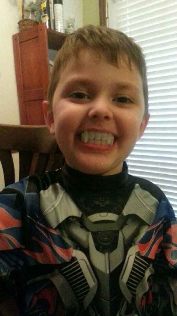 Had dentist appointment on Halloween.  Big smile