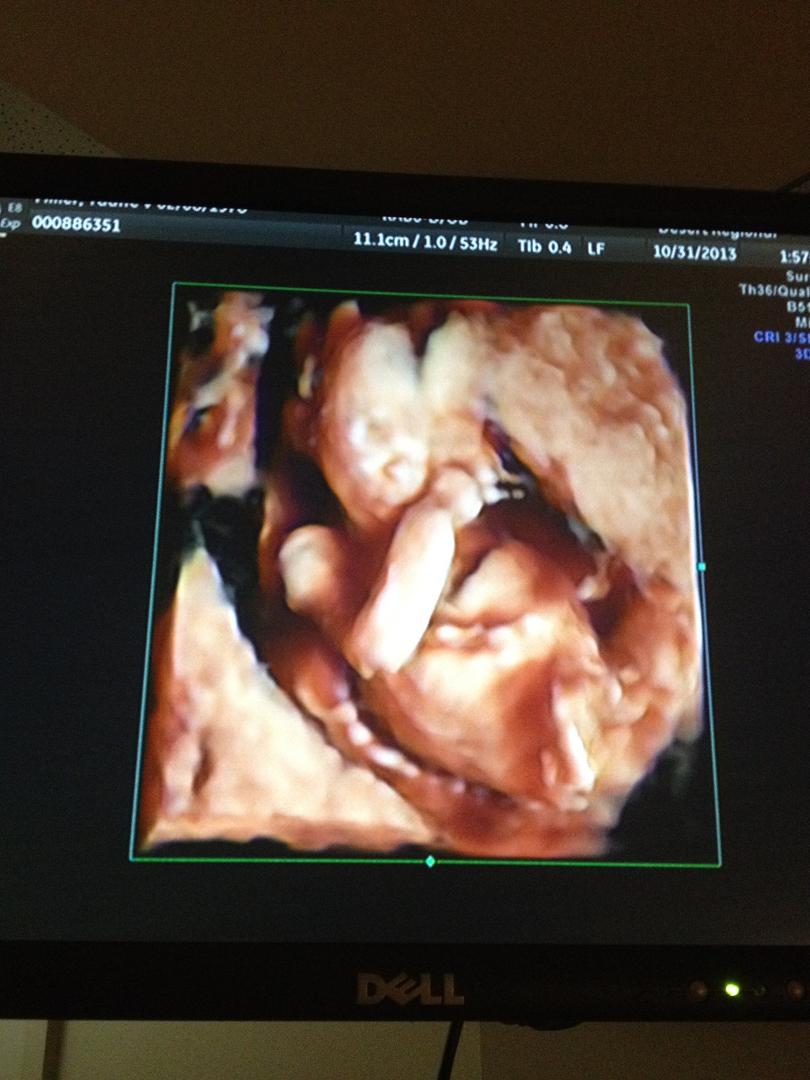 Here was the highlight of the doctor's appointment, getting to see a real life 3D picture of the baby! And Kendon is going to be a big brother to a little brother, it's a boy everyone! :)