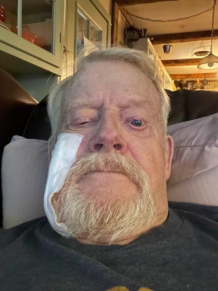 You should see the other guy!!