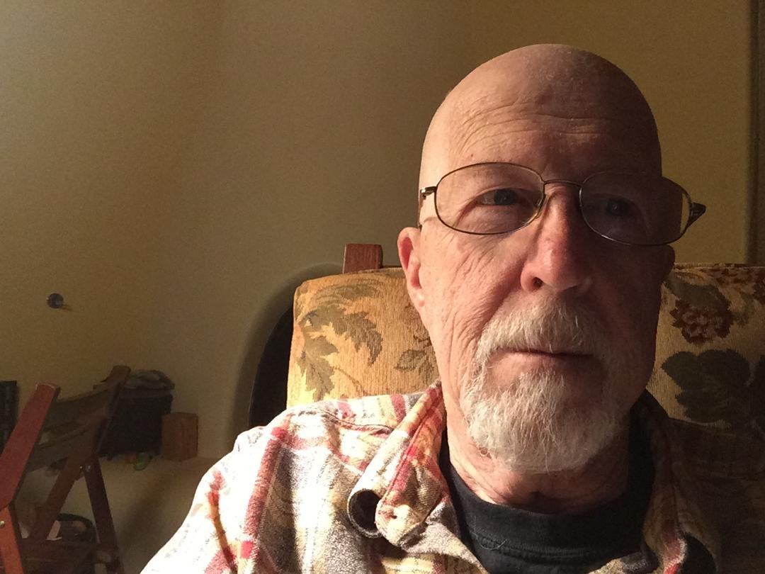 My best imitation of Walter White. I had to cut it all off because it was falling out in big clumps from the chemo. It seems I stepped on a land mine in Vietnam 57 years ago and it just went off. That landmine was agent ora