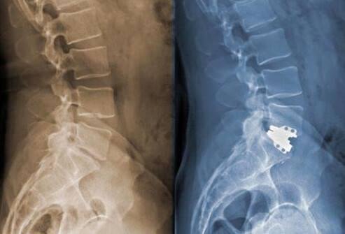 my back is on the right