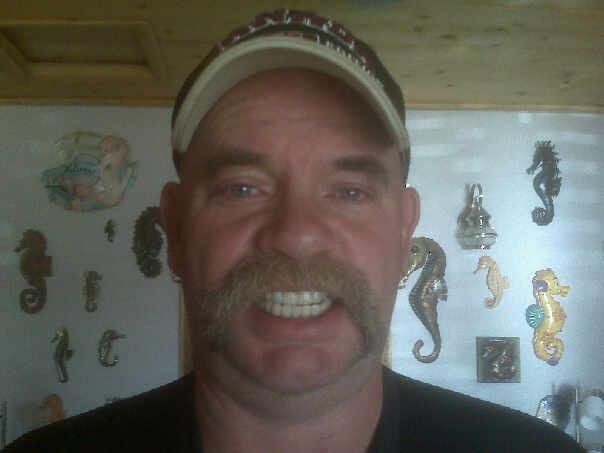 My new 3000 dollar smile
