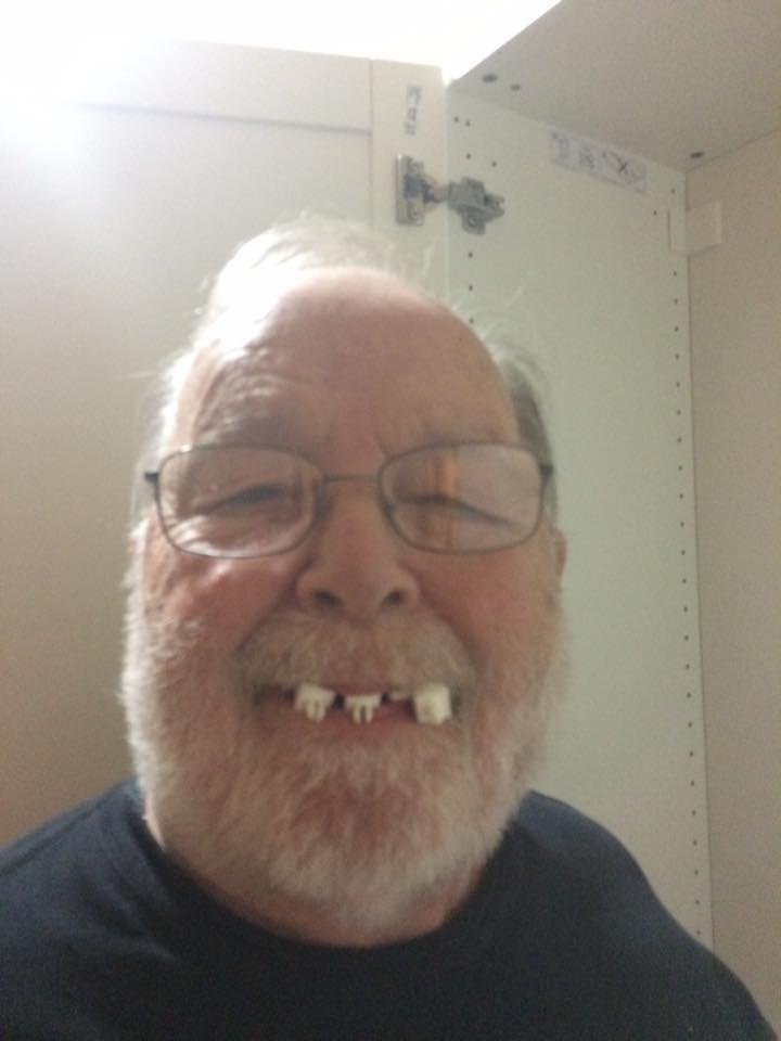 Teeth can't last forever