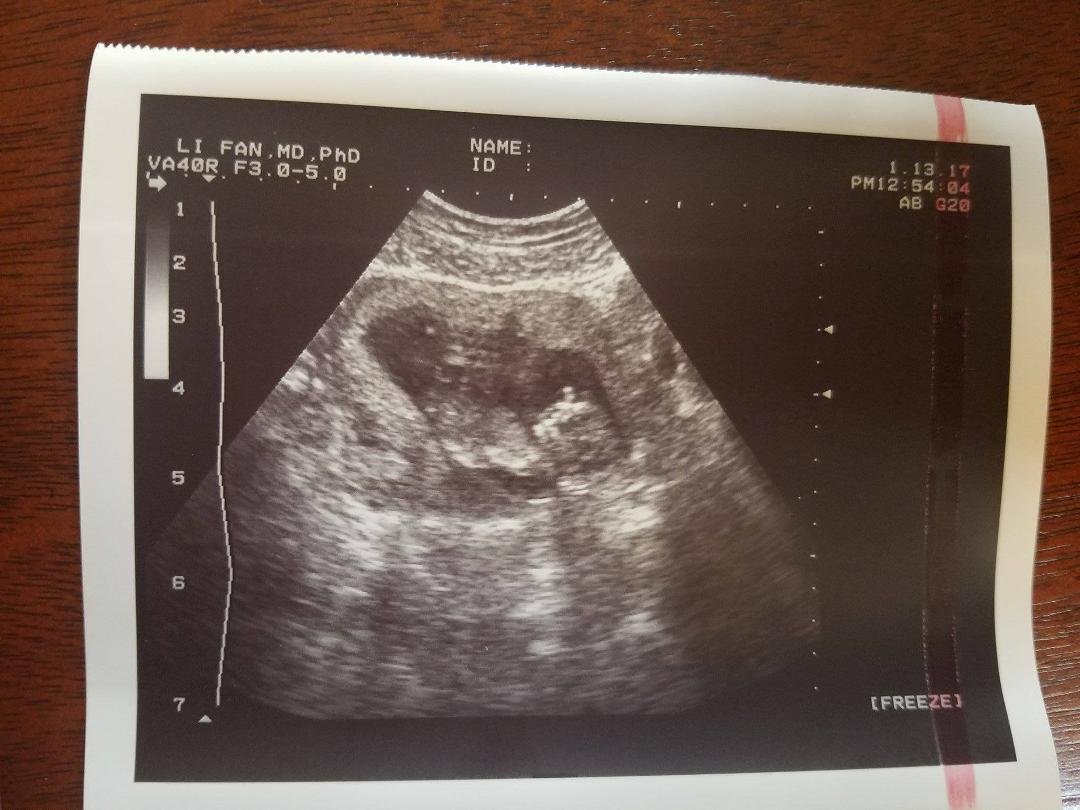 Newest picture of Grandbaby. I jumped the gun on the last post...Sorry, but just happy for Josiah and Tonya...I wanted all to know