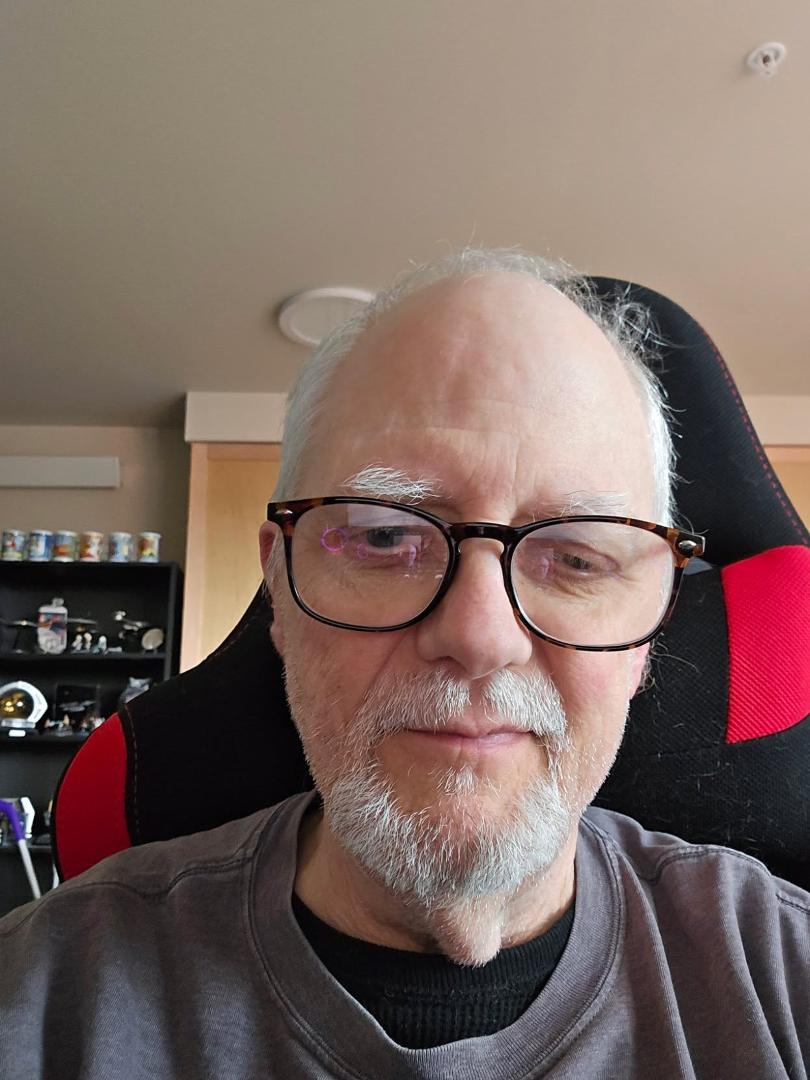 For all of you wondering what I look like now here it is. As you can see I have gotten older, I also have a rooster chin. Lost a lot of weight after I had my TAVR to fix the Cardiovascular heart failure I had. I am not look