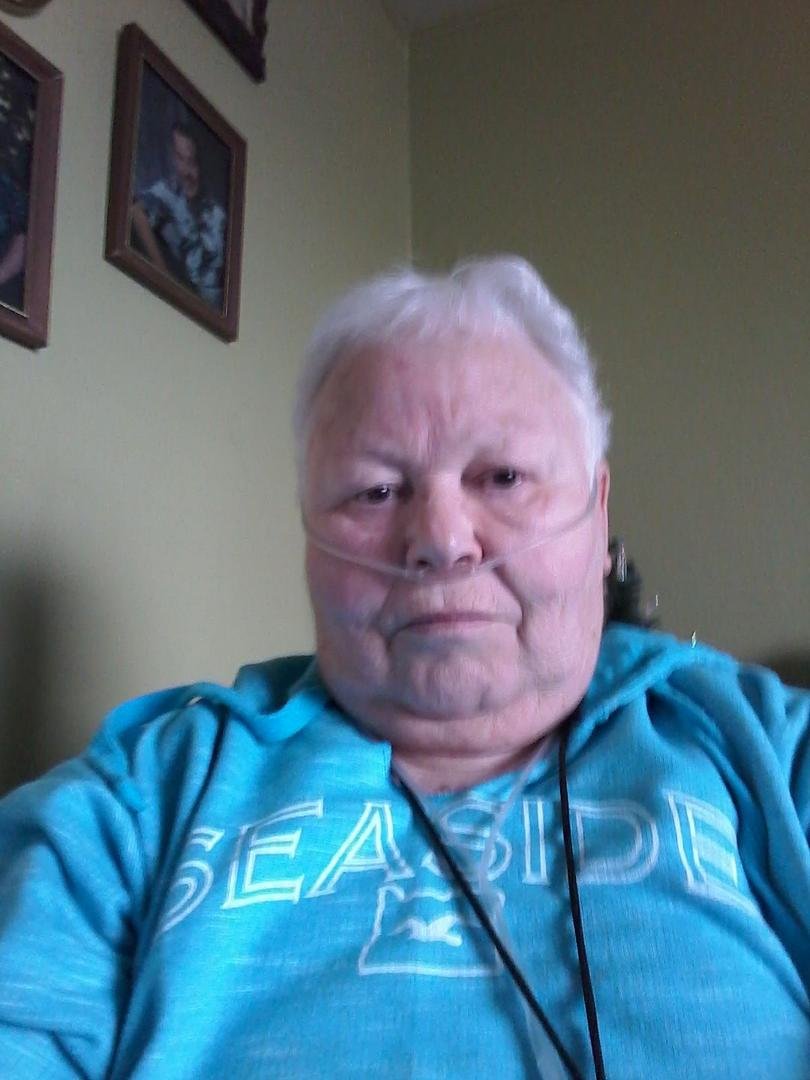 Dec 12 2017 ravages of COPD diabetic and other health issues GLAD TO BE ALIVE
