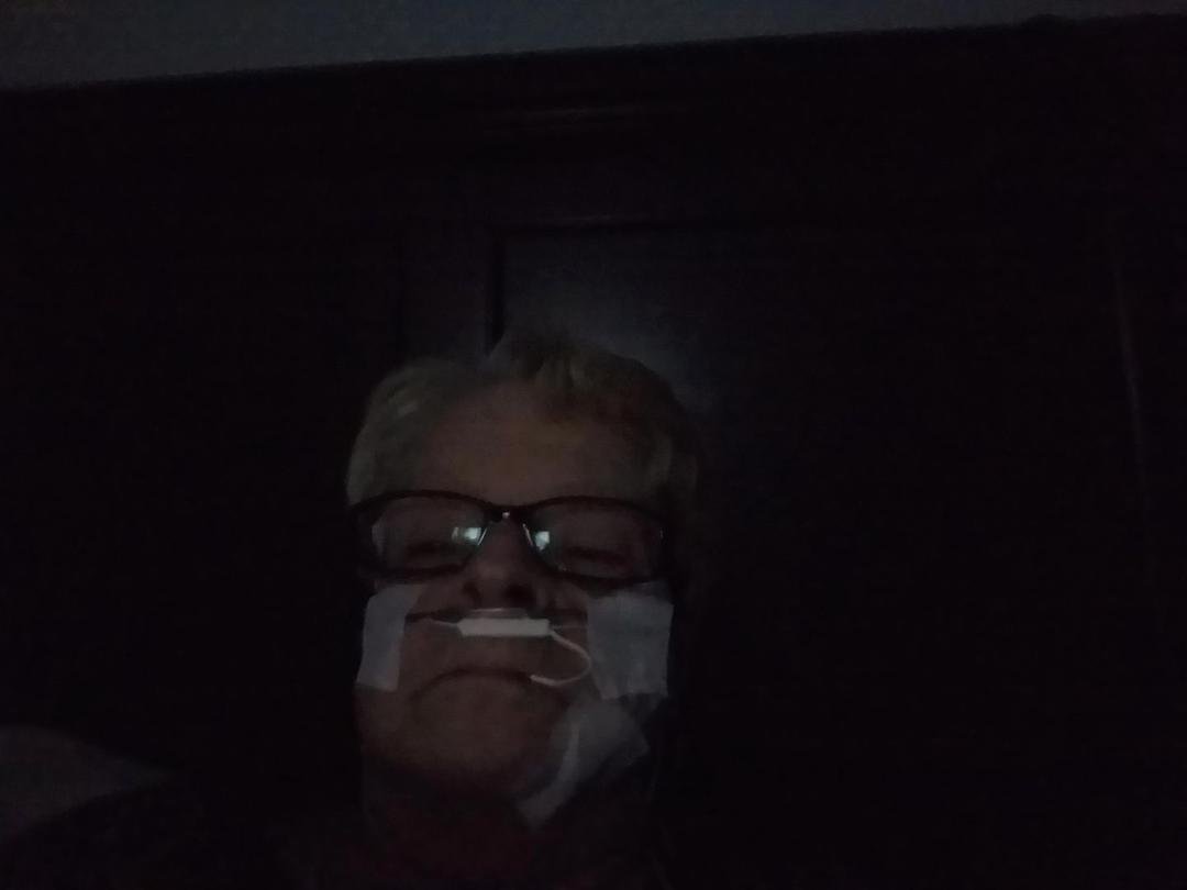 All wired up ready for sleep study. Hope I can sleep with all these wires on. Nitey, nite!
