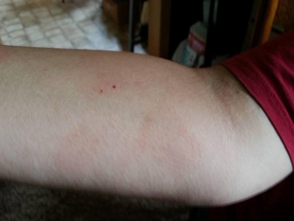 My arm.