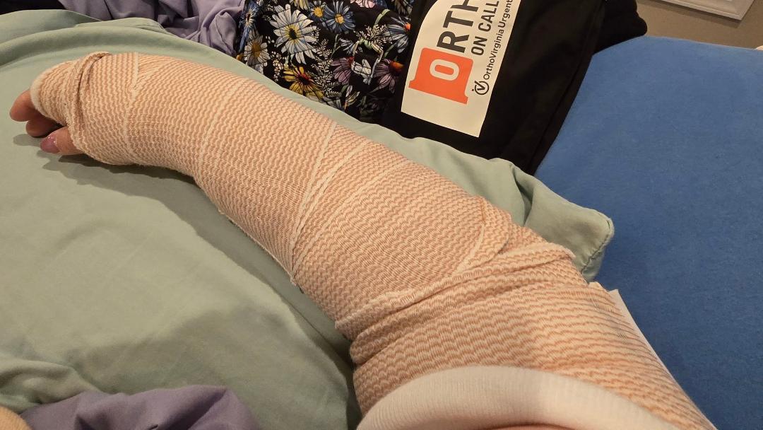 Well, my no break in elbow is actually broken. I'll have surgery in the next two weeks.