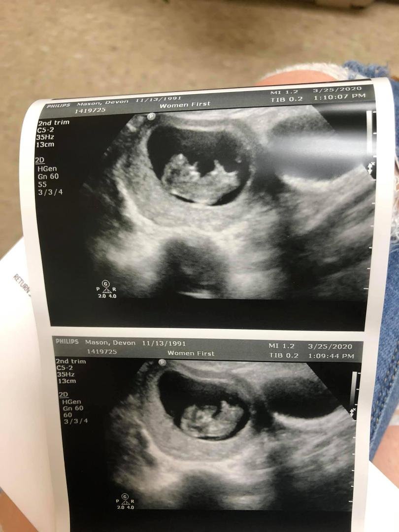 Well I finally got my Ultrasound done so I guess I can spill the beans...October Helm Baby in the works.
