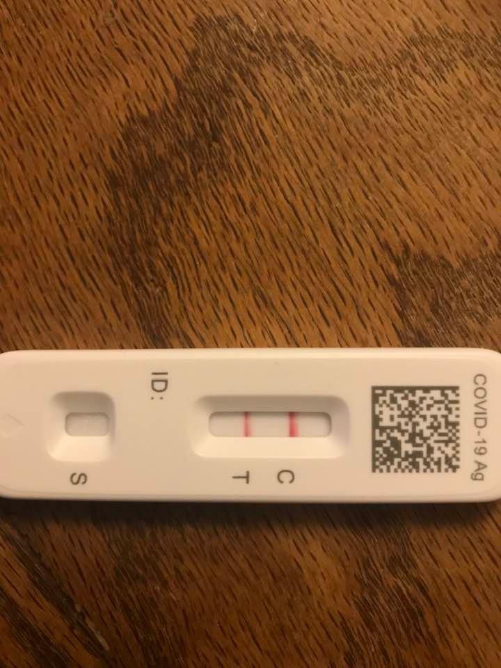 I am positive on the Antigen test