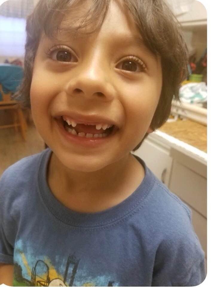 Another tooth gone! Pure joy❣️