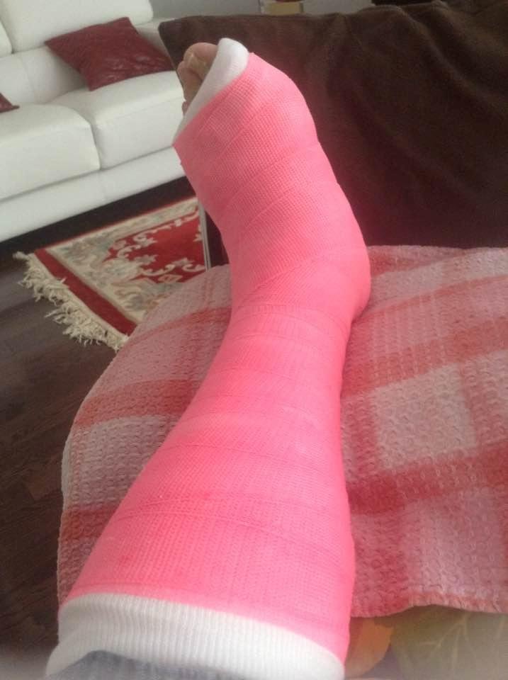HI! All, Here's the latest update. Went for my appointment today for 11:15am at the fracture clinic at Boxgrove and waited for two hours. Saw the specialist for my foot and now I have to be in cast for three weeks.