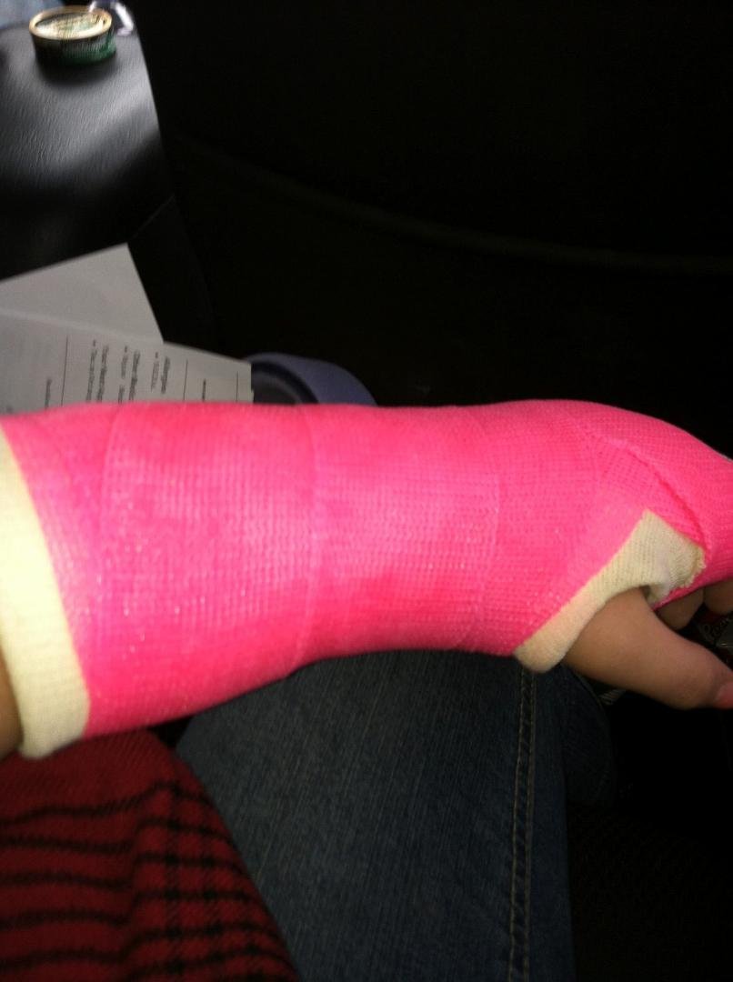 Today Steph Meier got her cast put on she was a trooper and can't wait for everyone to sign it! Love my girl
