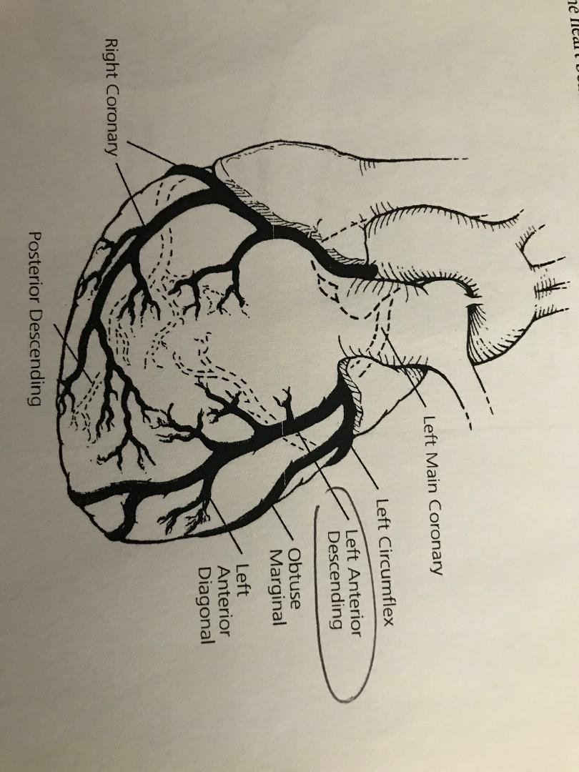 Spent yesterday at Medical Center of the Rockies. Appointment was at 6 am. Doctors found that my LAD was 100% blocked. While they had my heart on the table I decided to draw a quick picture which I have attached. The doc cl