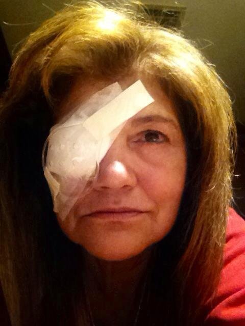 Wow was that fun. I hate having my eyes operated on. This is like the fifth time, & next week I get the other side done. Or is it the week after...