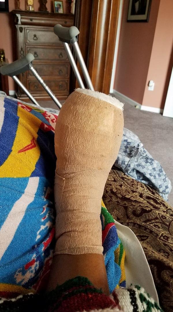 Had to have the foot taken care of and I have been taking the "dope" to "cope"!