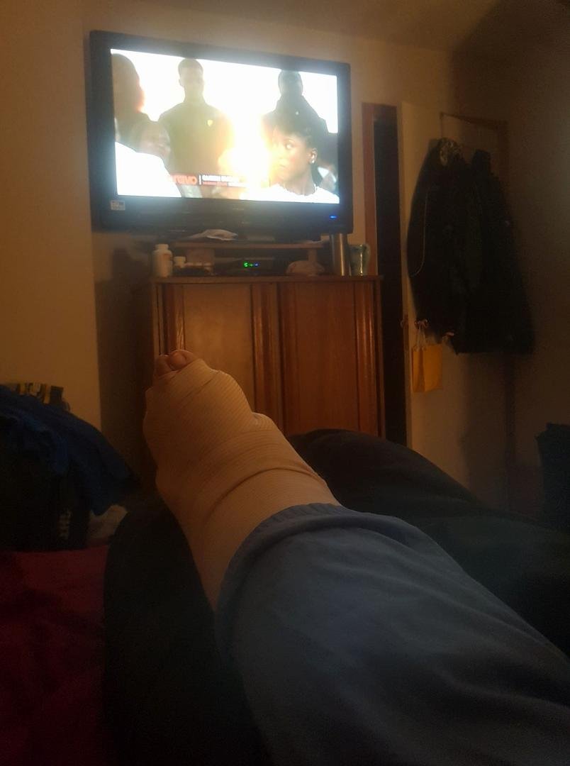 We are now home and settled in bed and yes brenda has a broken leg. The left fibula, just above the ankle. The cast is only temporary as we wait to go into surgery either tomorrow or friday to get it fixed right.