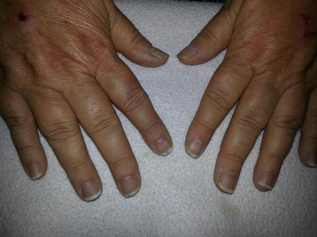Those of you who know will not believe this. REAL NAILS - not fake, on my hands.
