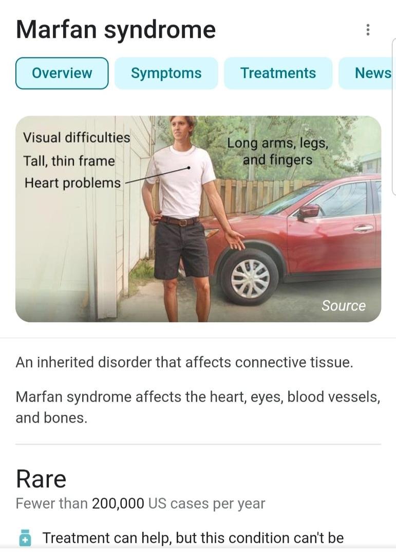 Does anyone have this or know anyone that does? Someone doesnt have the tall/skinny symptoms but the heart, lungs,etc ones.