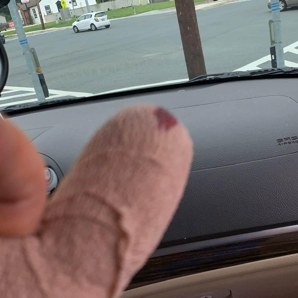 I’m on my way home surgeries done
