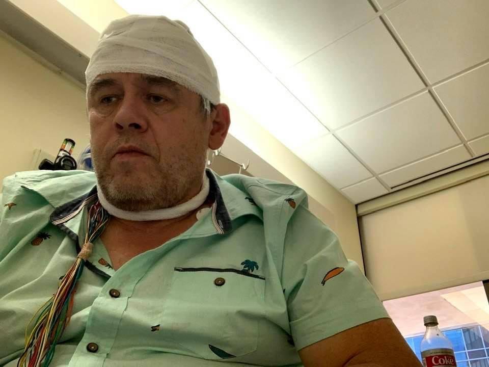The look one has when epilepsy has taken away any knowledge of ones name, past, wife, and the reason for being in the hospital. This photo shows me after having been caught trying to flee the hospital and having been talked