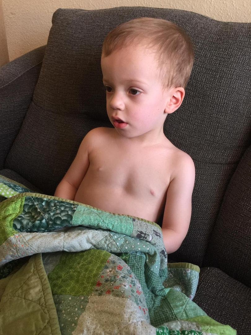 Poor guy has a fever.