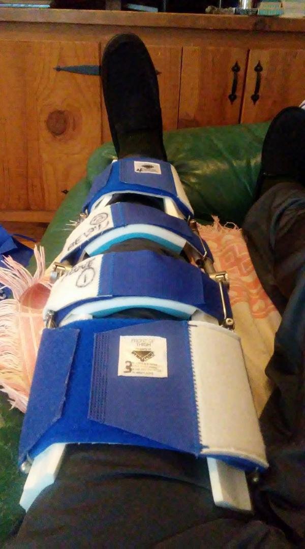 Have a new brace that I'm to wear 2 hours a day on days when I have therapy, and 3 hours a day on days that I don't. The brace is to help me straighten the knee. Comparisons to "the rack" wouldn't be too far off. The good n