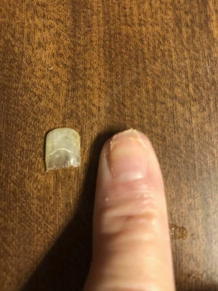 My nail finally came off today. Result of slamming the car door on my finger in November. Took long enough. Now I can’t wearing a bandaid. Happened around thanksgiving and ended near Easter. Woohoo