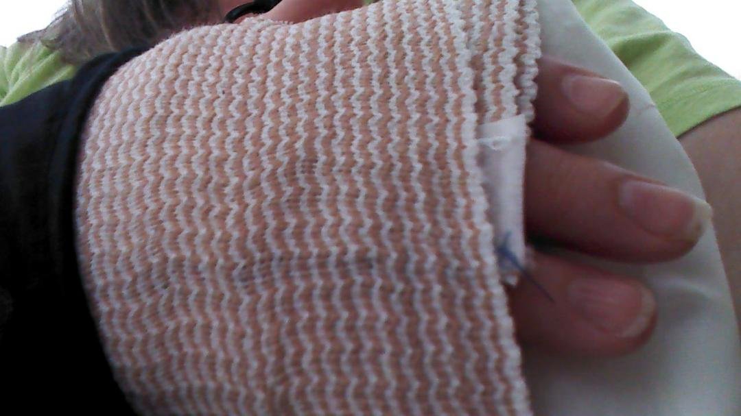 Fell on right wrist last night and broke it!  Taking it easy today. Doc appt on monday. Does not hurt too bad so maybe won't take a long time to heal.  Hope so anyway!