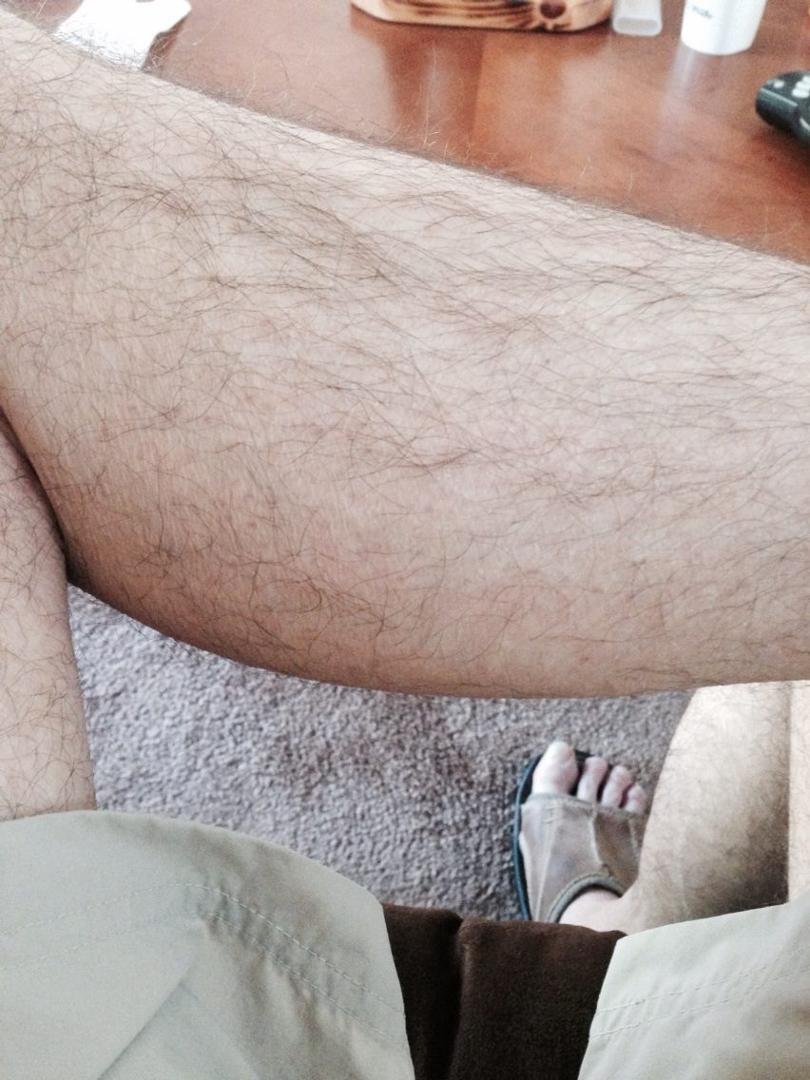 White Leg Selfie, needs Sun Bad!!! Lol