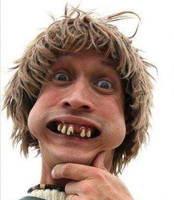 /Users/glen/Desktop/weird-teeth-face.jpg