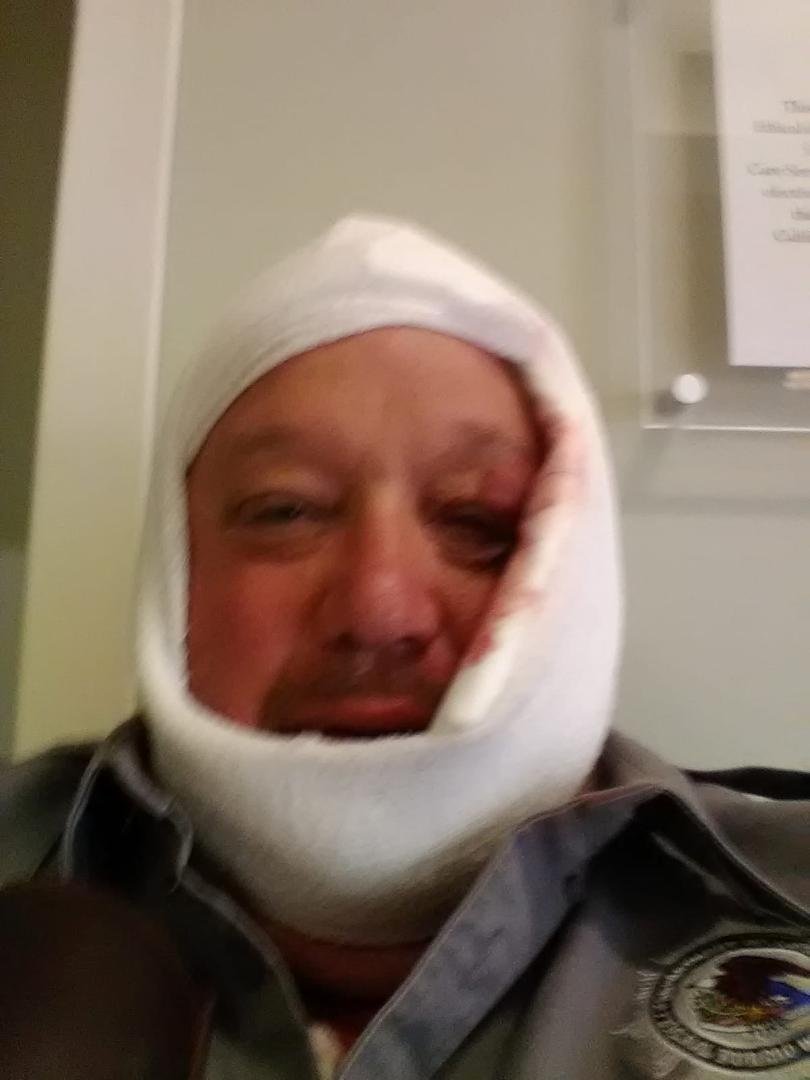 Hell of a way to start a holiday weekend...kids, this is what happens when a freight elevator makes contact with your head. Elevator, 1; Fred, 0.
