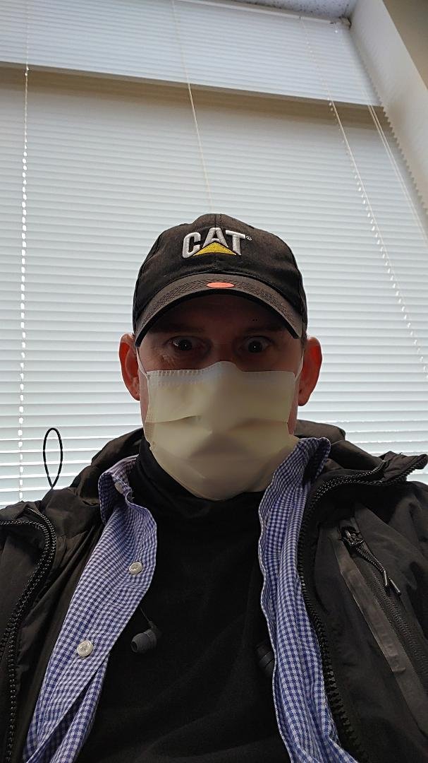 Urgent care day. Seems infections are catchy. Who woulda thunk.?.
All I can say is......the pain the pain.