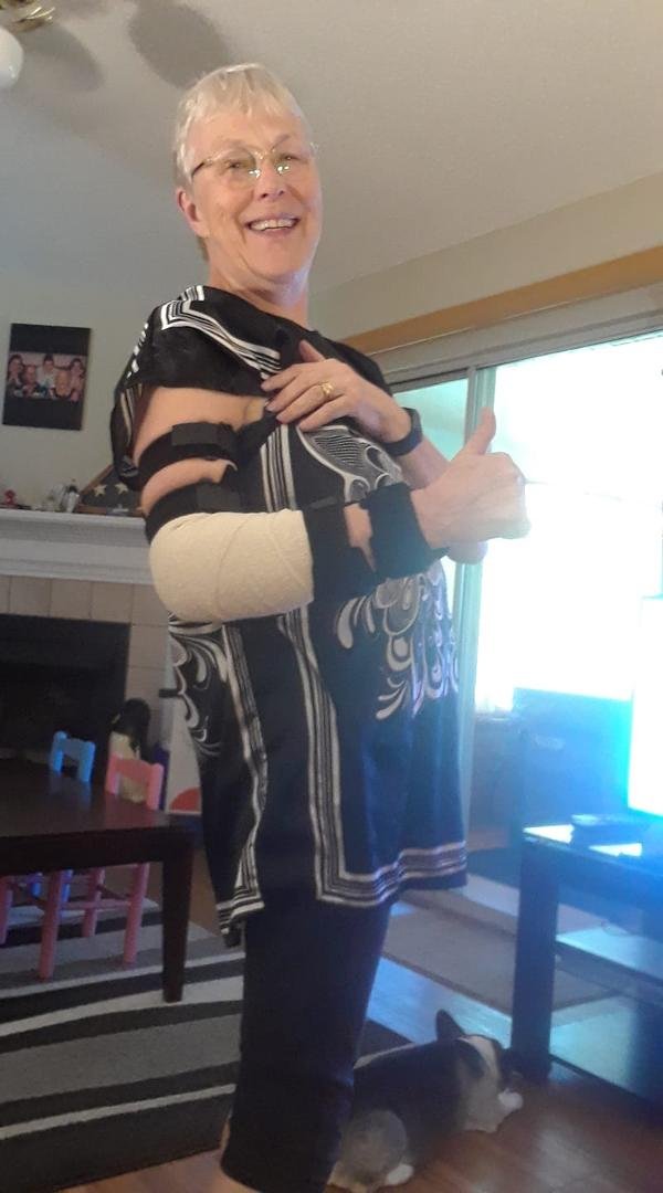 Hurrah out of cast, new brace, driving. Thx Bill for your help!!!