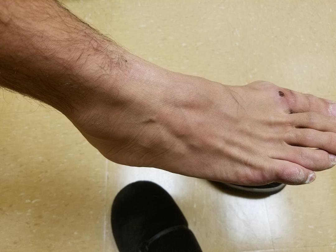 YAHOO!!!! No more cast.