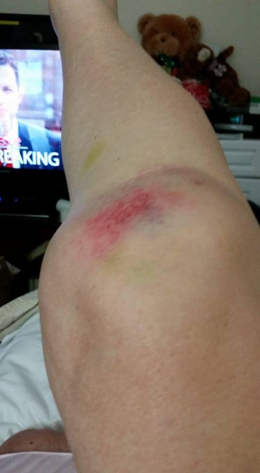 When will I stop racing in my wheelchair?