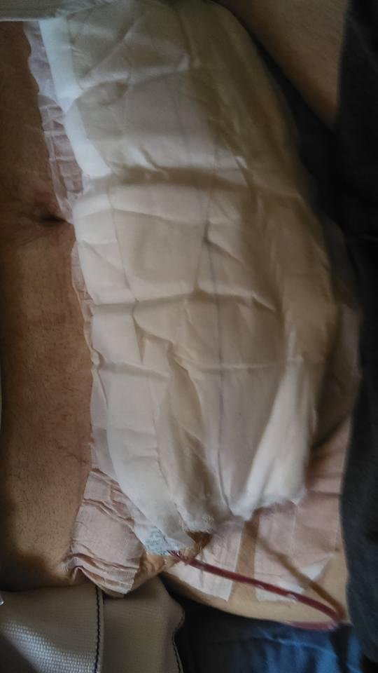 This is what I had done