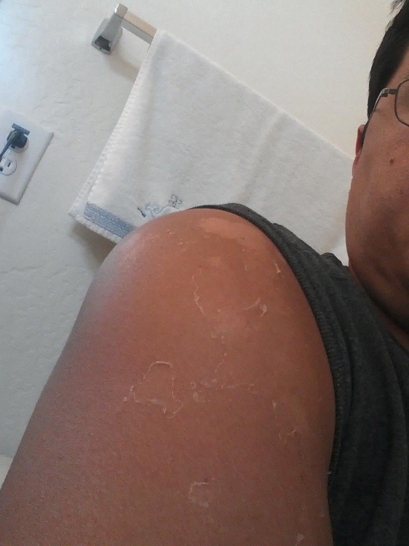 I'm peeling yay