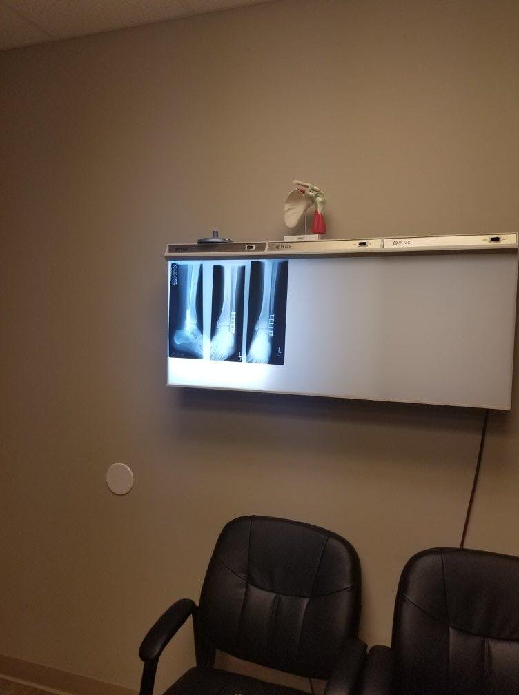 X ray  look close you ca see the screws and plate