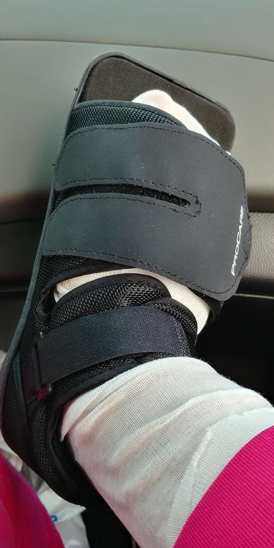 Ouch! This thing is sure swollen. Ice and elevate.