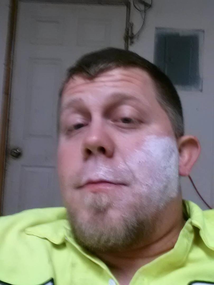 Yea calamine lotion on the face poison oak sucks
