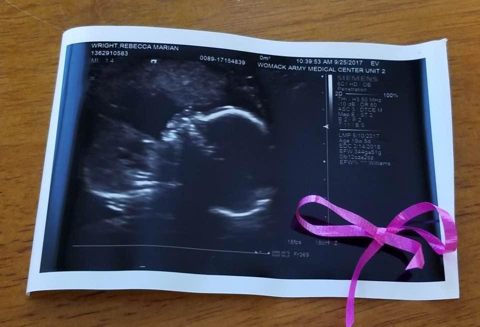 Granddaughter #6 on the Way! 😆😆😆😆😆😆 Very happy Grandpa!