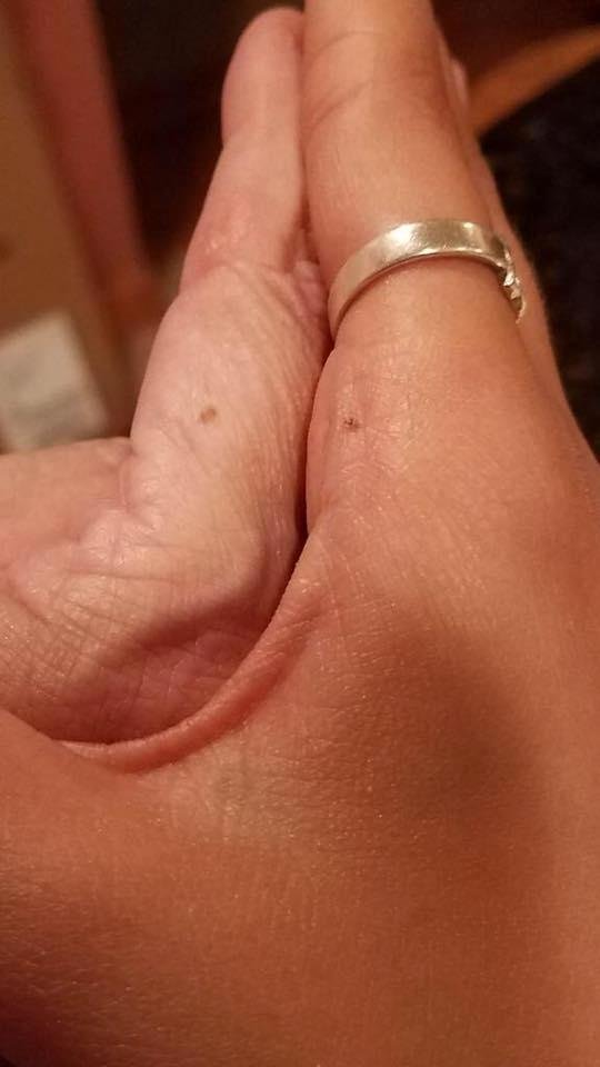 My hand and my daughters hand we both have the same mole on the same hand on the same spot and so does my sister aren't family genetics funny