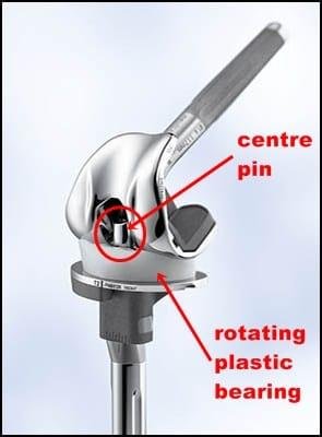 This is my knee joint now.