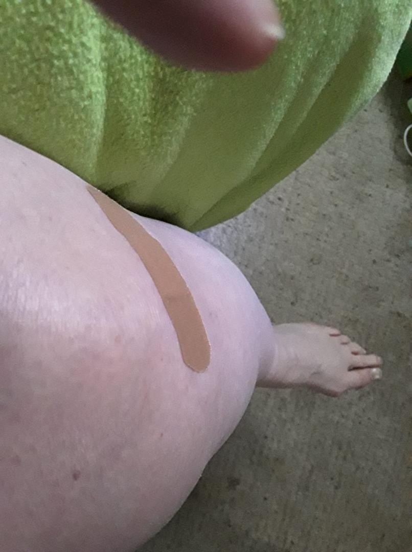I was scared to death but I went through with getting a shot in my knee yesterday.
This morning I am pain free!!  OMG it is wonderful. 😁