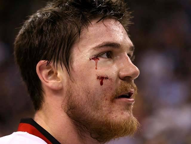 Andrew Shaw. Picture of a hockey player? Hell yeah!