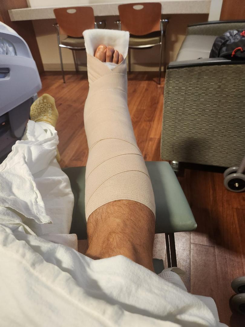 Got some new metal installed. Ankle replacement surgery was a success. Now comes the hard part.